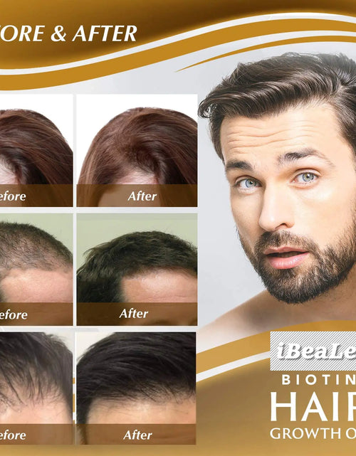 Bild in Galerie-Viewer laden, Ätherische Öle für die Haarpflege
